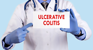 Ulcerative Colitis Ulcerative Colitis